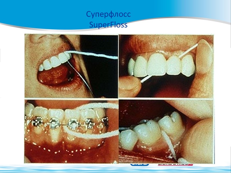 Суперфлосс SuperFloss